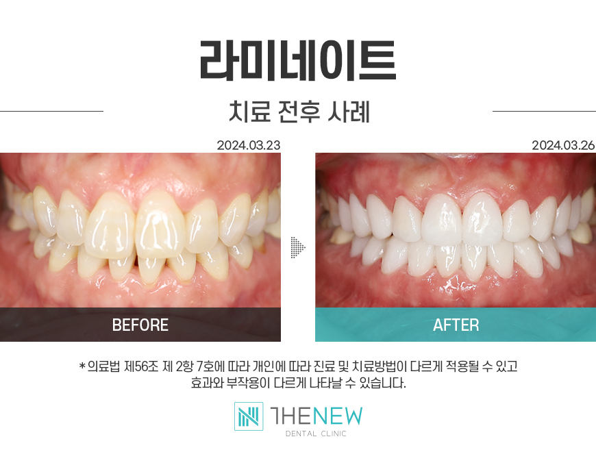 업로드된 이미지