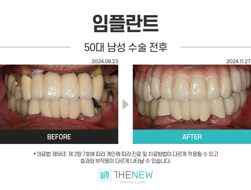 업로드된 이미지