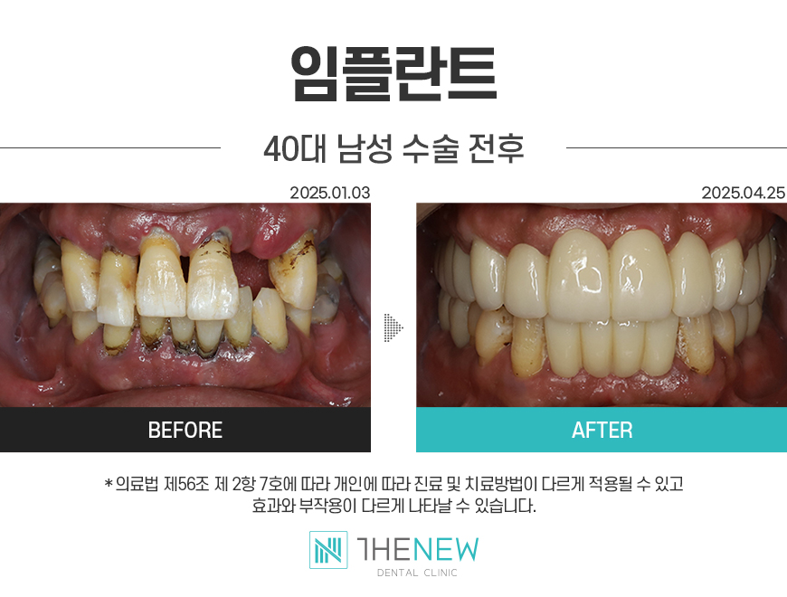 업로드된 이미지