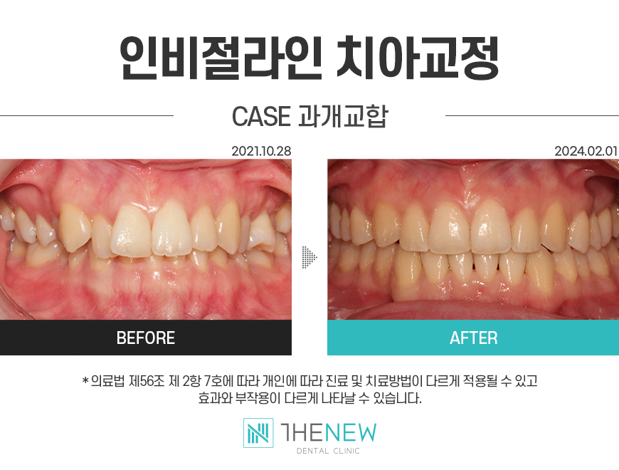 업로드된 이미지