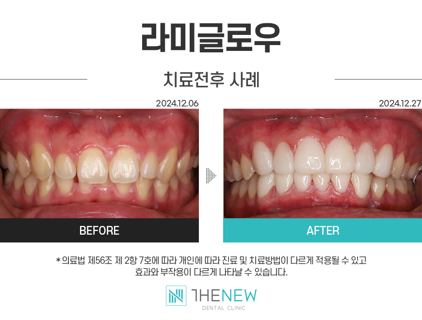 업로드된 이미지