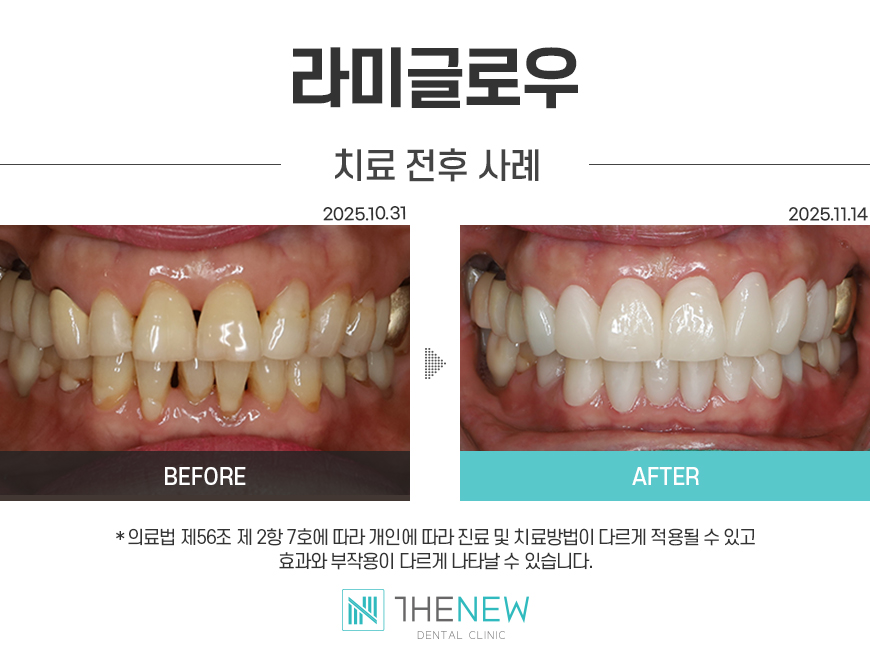 업로드된 이미지