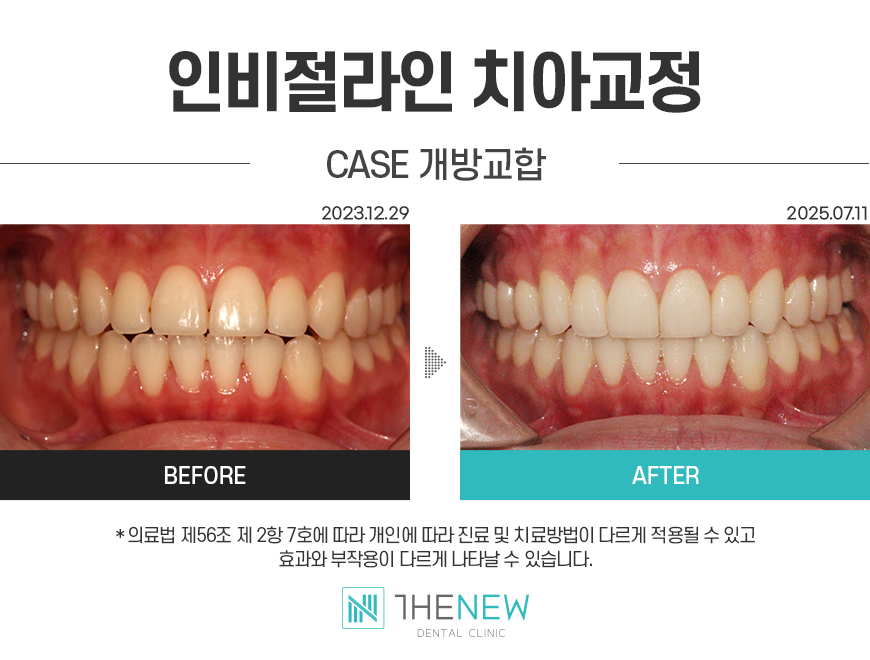 업로드된 이미지