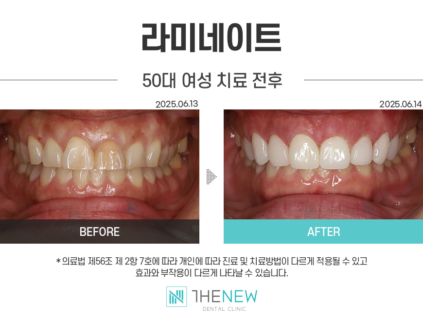 업로드된 이미지
