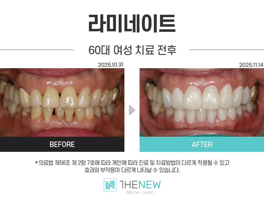 업로드된 이미지