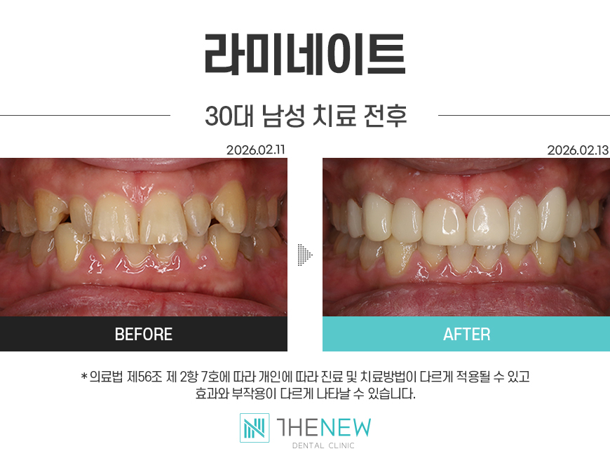 업로드된 이미지