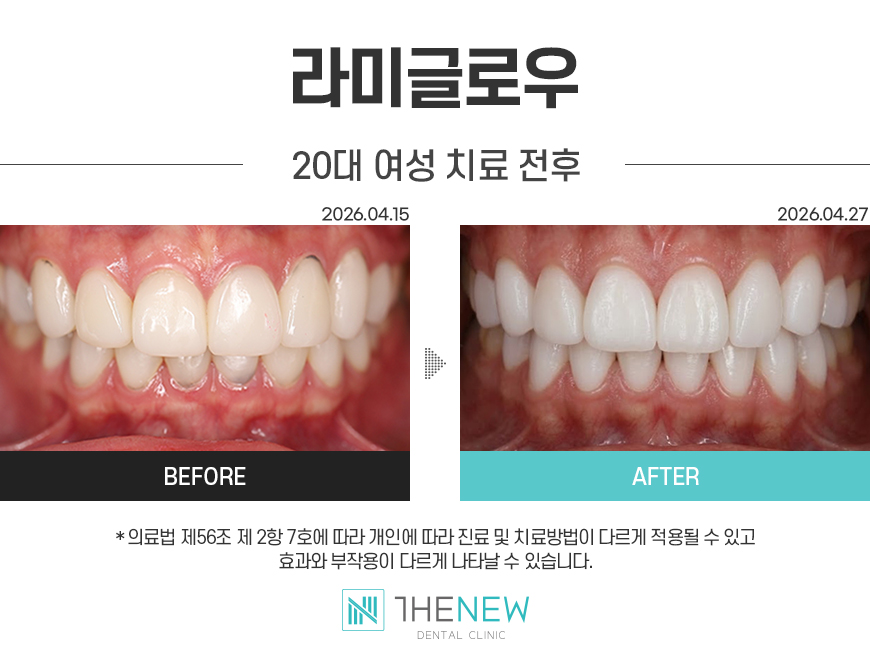 업로드된 이미지